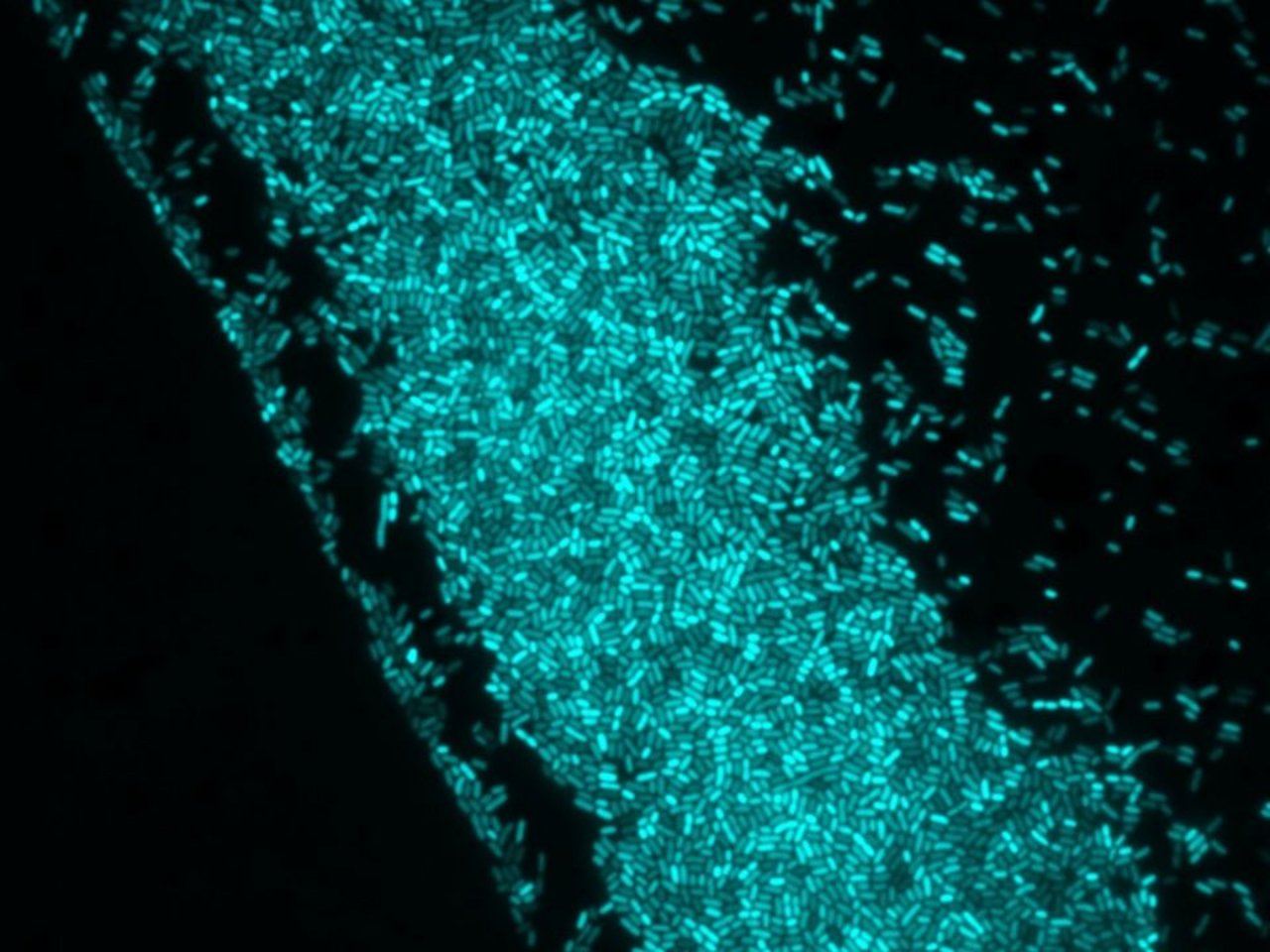 Cellule batteriche al microscopio a fluorescenza class=