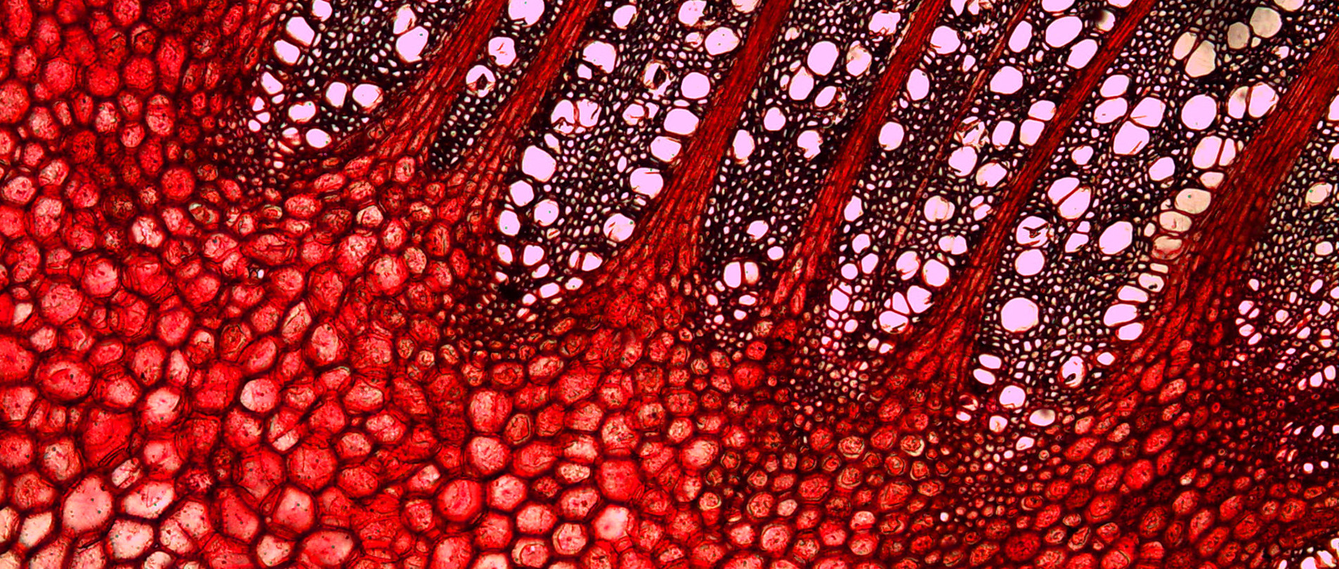 Section of a tree trunk under a microscope